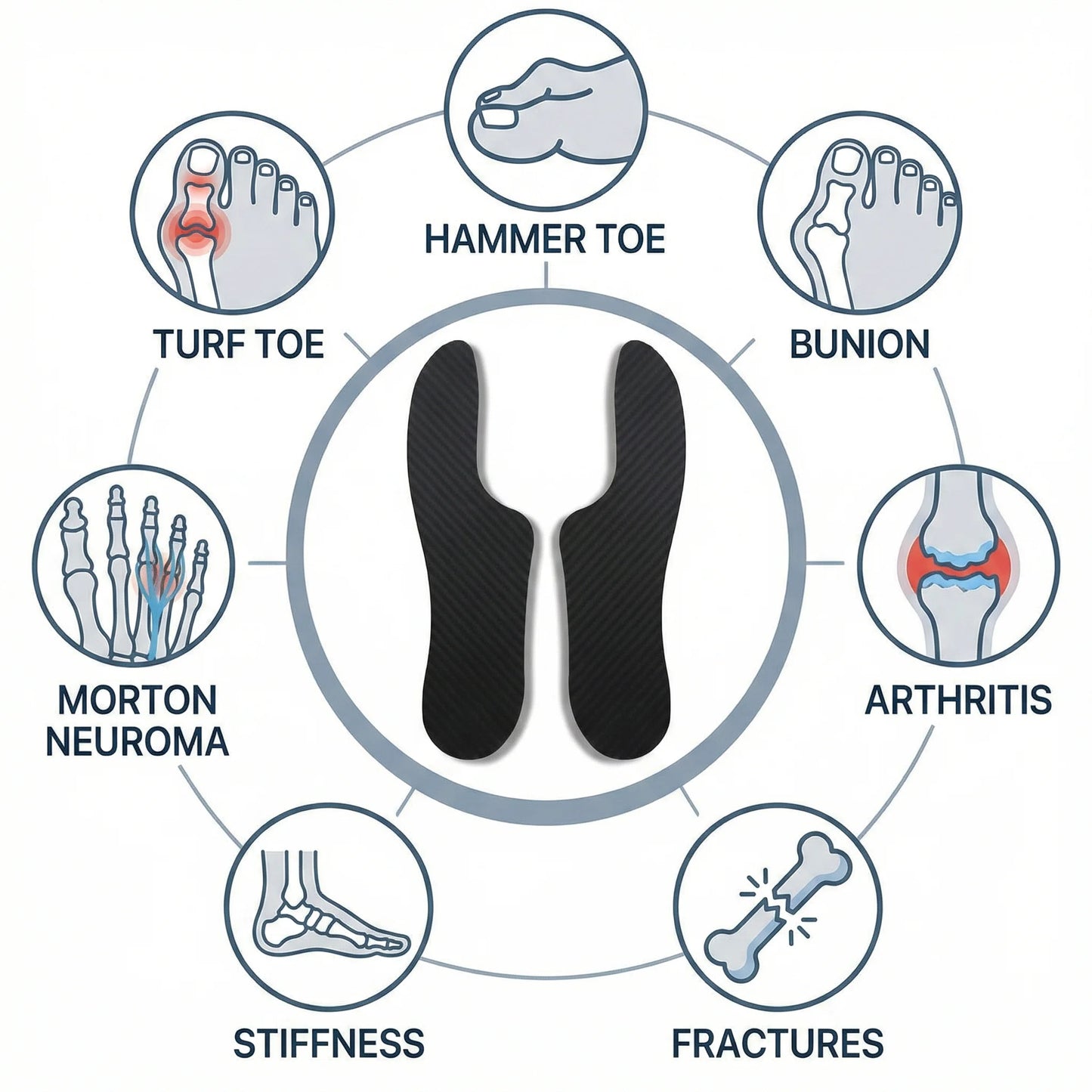 Morton'S Extension Orthosis, Carbon Fibre Insole, 1 Pair, 1.5Mm Thick, Very Rigid Foot Support Stiffening Plate, for Hallux Limitus/Rigidus，Turf Toe, Arthritis, 26.5Cm