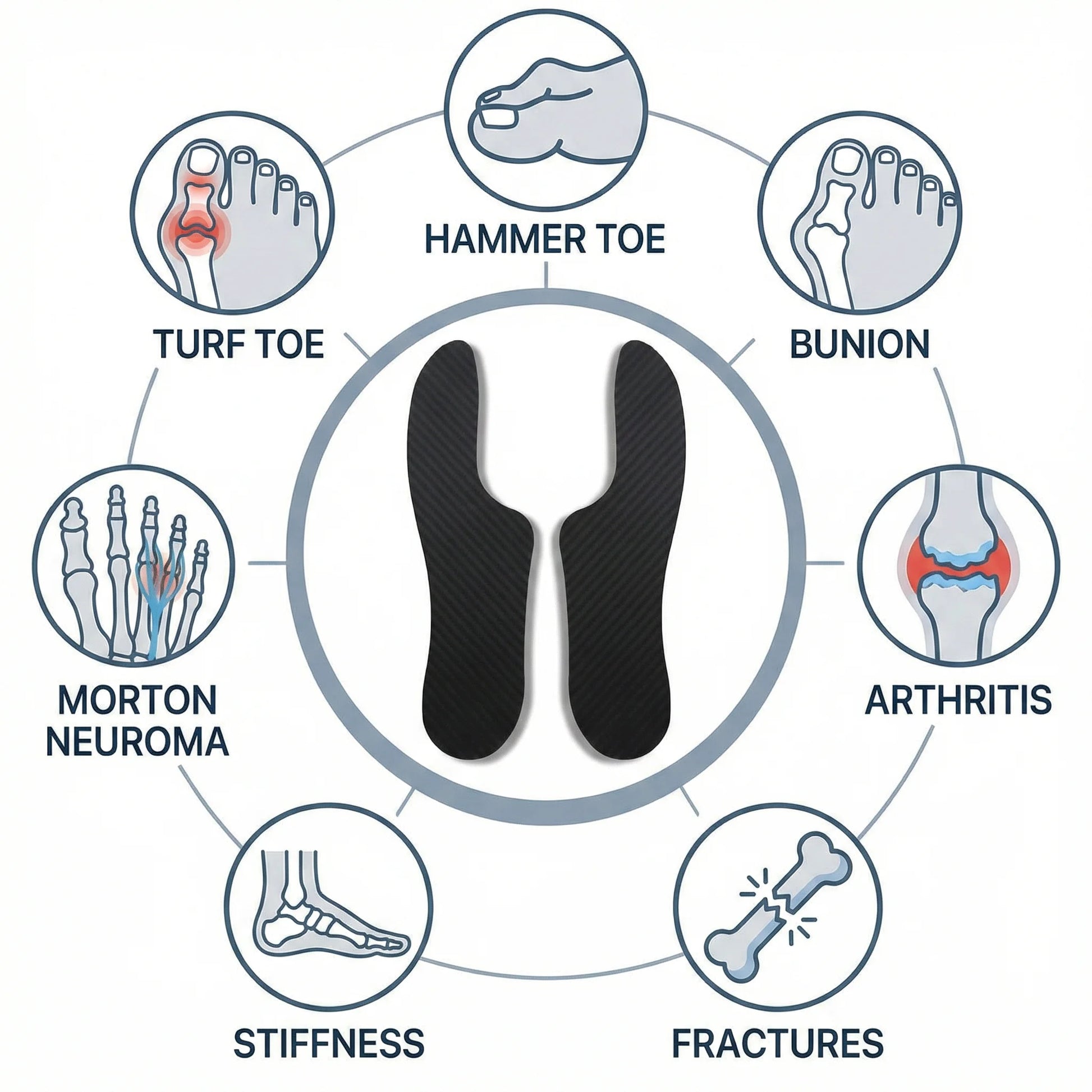 Morton'S Extension Orthosis, Carbon Fibre Insole, 1 Pair, 1.5Mm Thick, Very Rigid Foot Support Stiffening Plate, for Hallux Limitus/Rigidus，Turf Toe, Arthritis, 26.5Cm