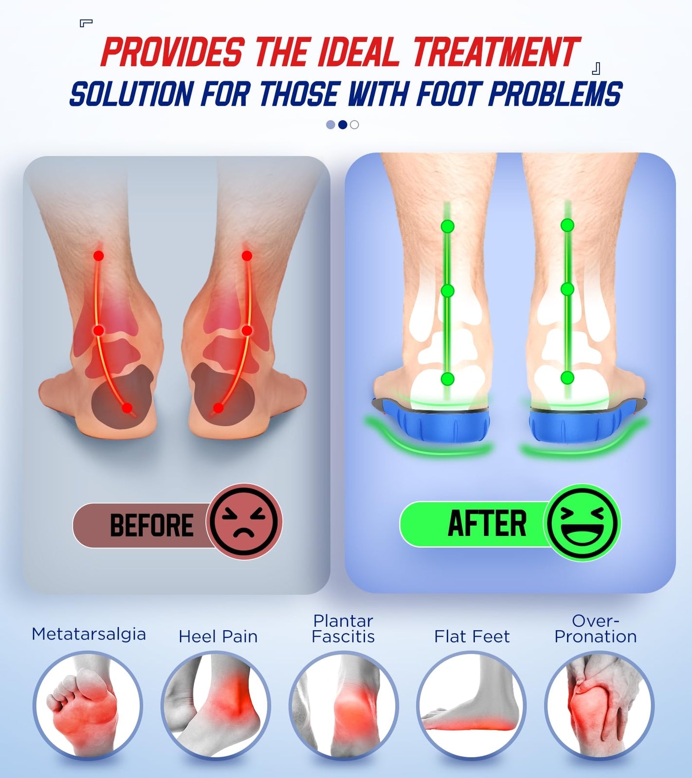 NEUPU Orthotic Insoles for Men and Women High Arch Support Foot Pain Relief